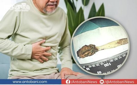 চীনে বৃদ্ধের পেট থেকে বের হলো ৫২ বছর আগের টুথব্রাশ!