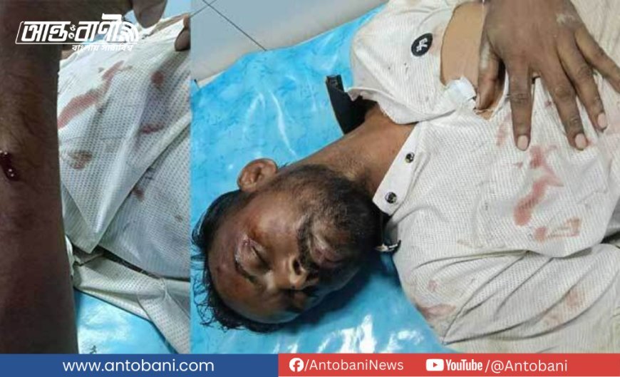 হিরো আলমের ওপর দুর্বৃত্তদের হামলা